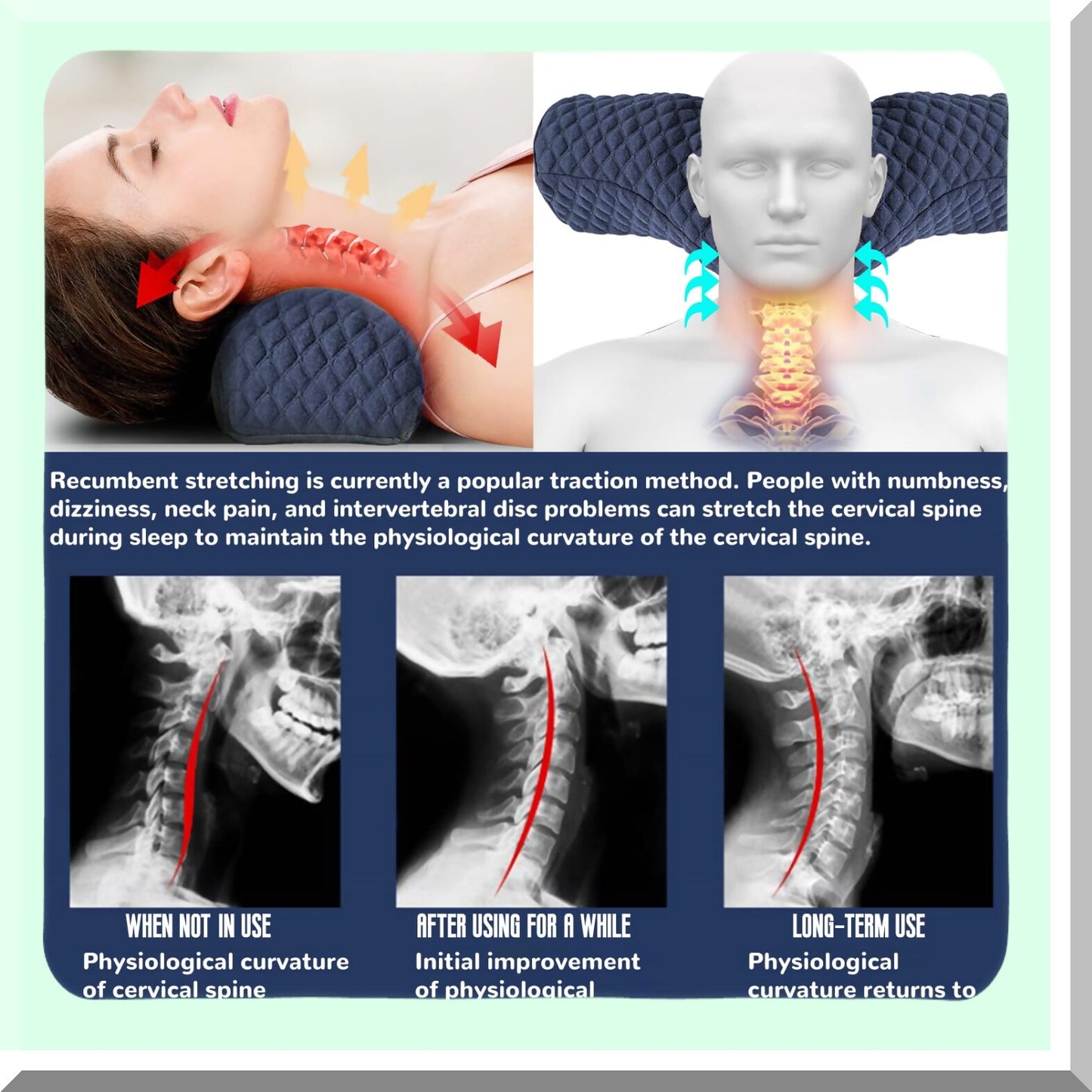 SleepEase Memory Foam Neck Support Pillow - Pain Relief Bolster for Side and Back Sleepers - White Orthopedic Cervical Roll Pillow