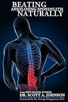 Overcoming Ankylosing Spondylitis Naturally