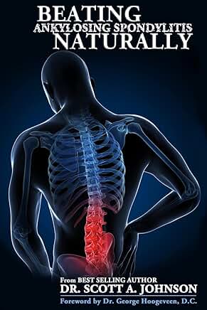 Overcoming Ankylosing Spondylitis Naturally