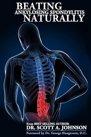 Overcoming Ankylosing Spondylitis Naturally