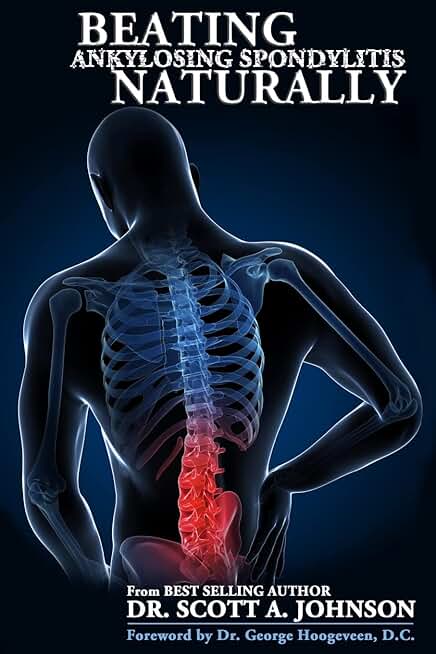 Overcoming Ankylosing Spondylitis Naturally