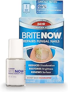 Nail Treatment for Damaged and Discolored Nails